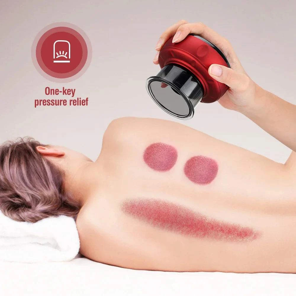 Electric Vacuum Cupping Body MassageElectric Vacuum Cupping Body Massage